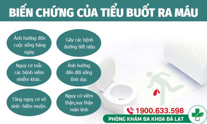 Hình ảnh minh họa